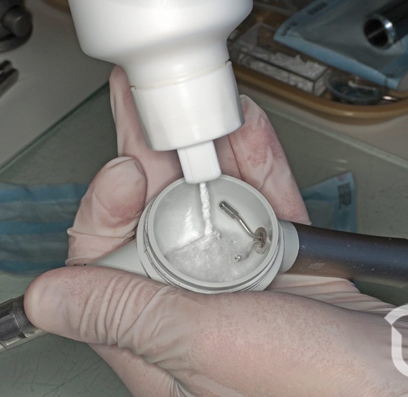 La pistola de aero-pulido tiene una cámara estanca que se carga con el polvo de glicina y al cerrarla, éste se mezcla con agua del equipo para salir a presión por la boquilla y poder irrigar las superficies contaminadas.