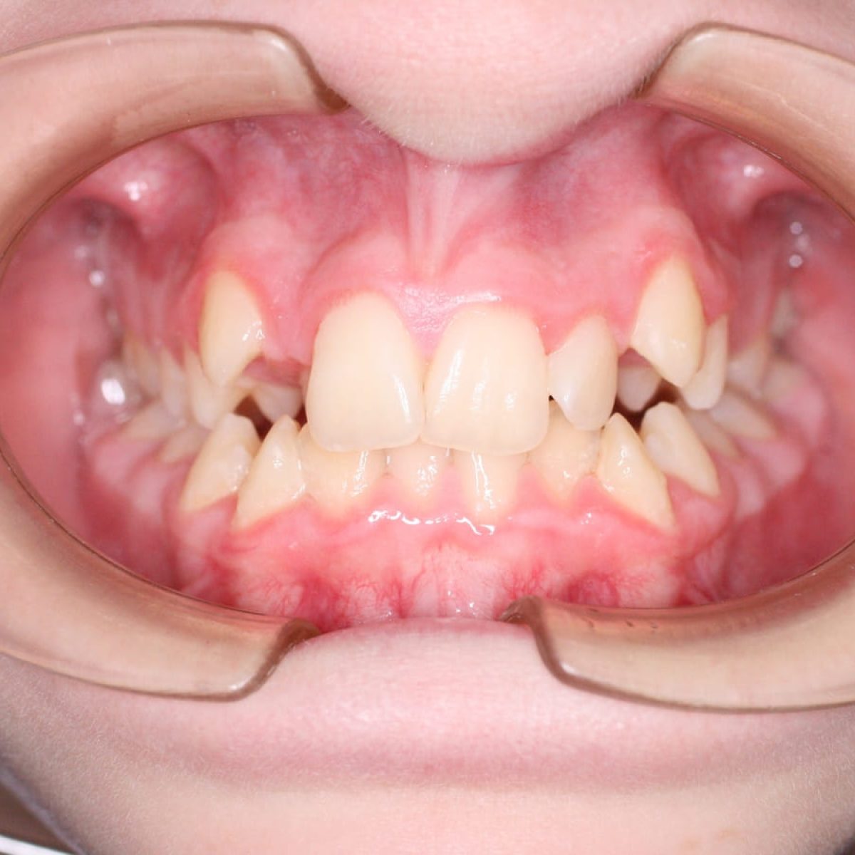 Imagen – Ortodoncia Más Allá de la Estética Imagen - Ortodoncia Más Allá de la Estética